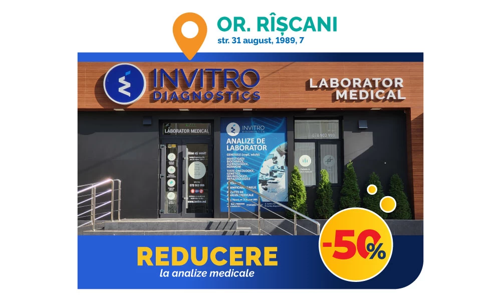 -50% reducere la analize, în filiala din or. Rîșcani!